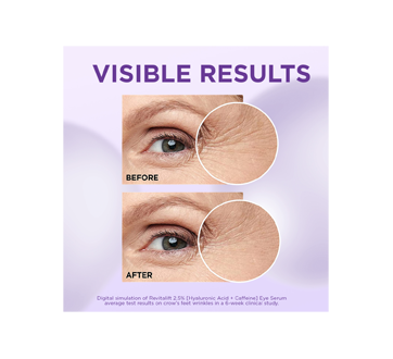 Image 6 of product L'Oréal Paris - Revitalift Triple Power LZR Eye Serum, 20 ml