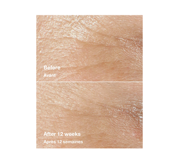 Image 4 of product Clinique - Smart Clinical Repair Wrinkle Correcting Cream Rich, 50 ml