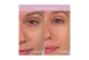 Vignette 12 du produit Watier - Lift & Firm 3D Patch lift contour yeux, 6 unités
