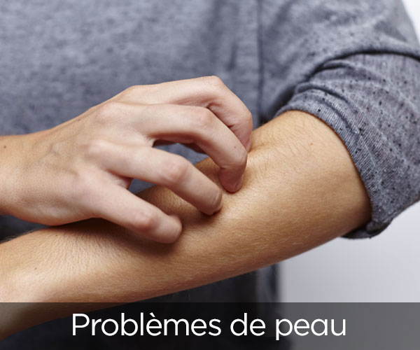 Problèmes de peau