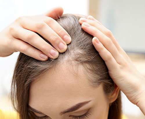 À L’AIDE! MES CHEVEUX S’AFFINENT! 