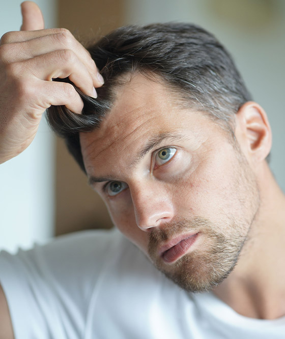 Understanding hair loss 
