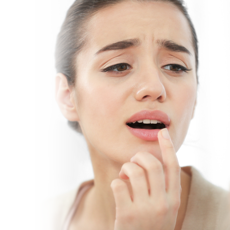 5 tips to avoid cold sores during the holidays