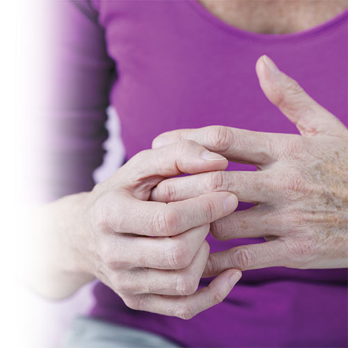 Arthritis and osteoarthritis