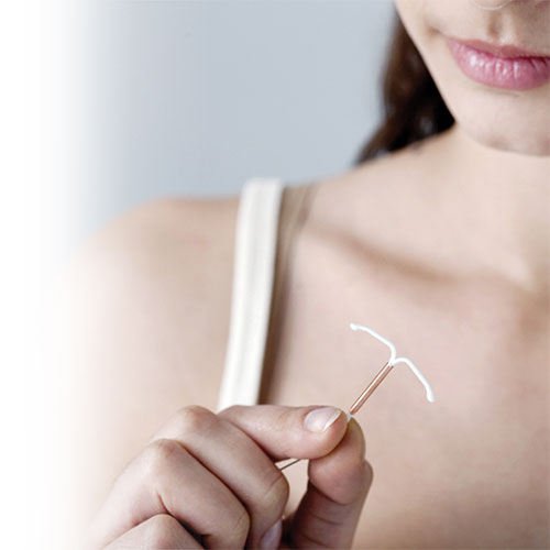 Intrauterine device: myths and realities