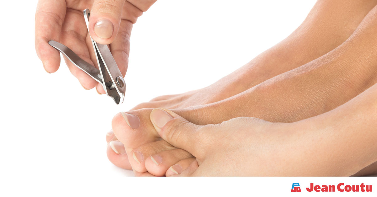 Why Antibiotics Won't Fix Your Ingrown Toenail