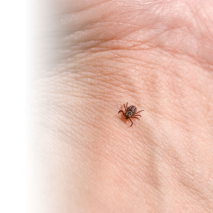 Lyme disease: the tick, an insect that infects