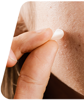Patchs anti-boutons : discrets et efficaces